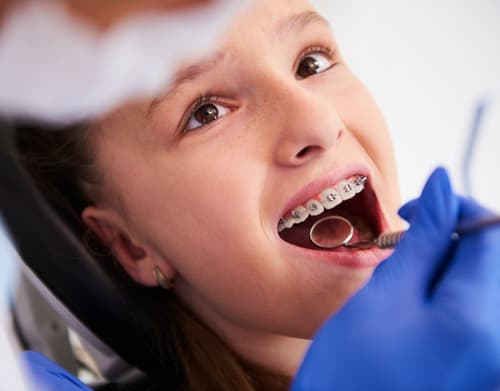 Braces