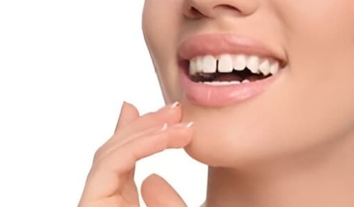 Diastema — before treatment