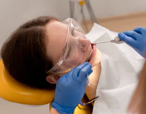Root Canal