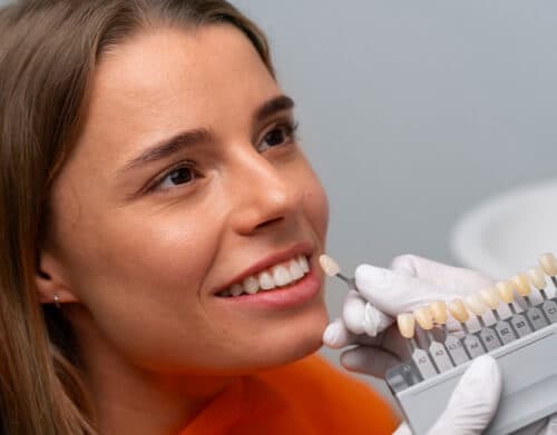 Veneers
