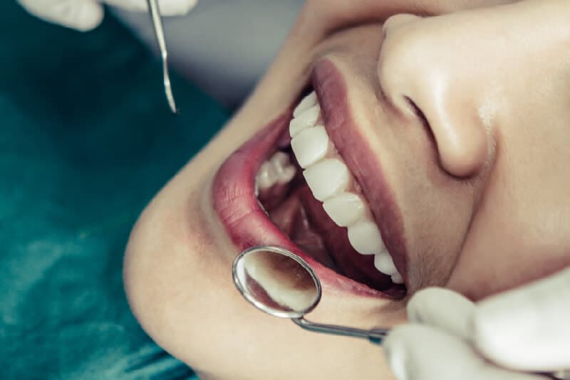 Aesthetic Dentistry Backed by Precision