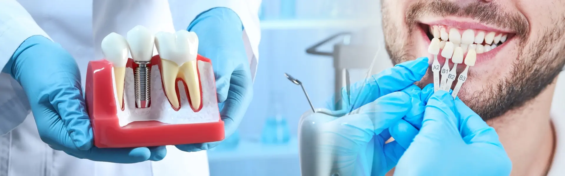 Dental implant prosthesis